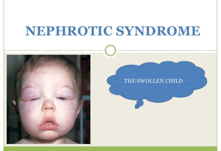 No preview available